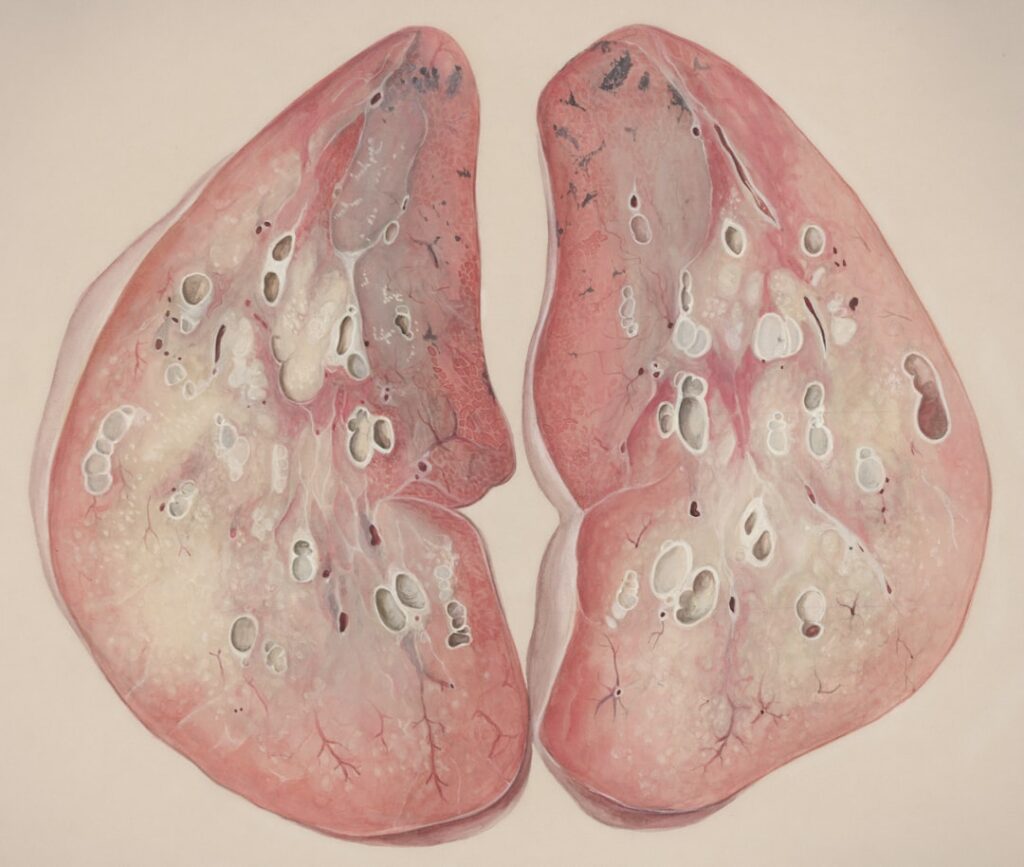 Skutki przewlekłego stresu dla kondycji narządów wewnętrznych